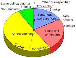 أنواع سرطان الرئة